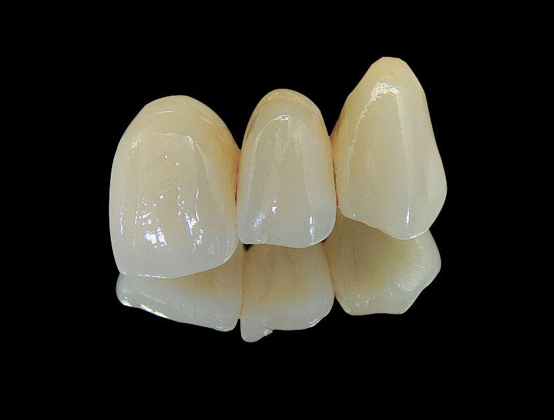 Layered Zirconia
