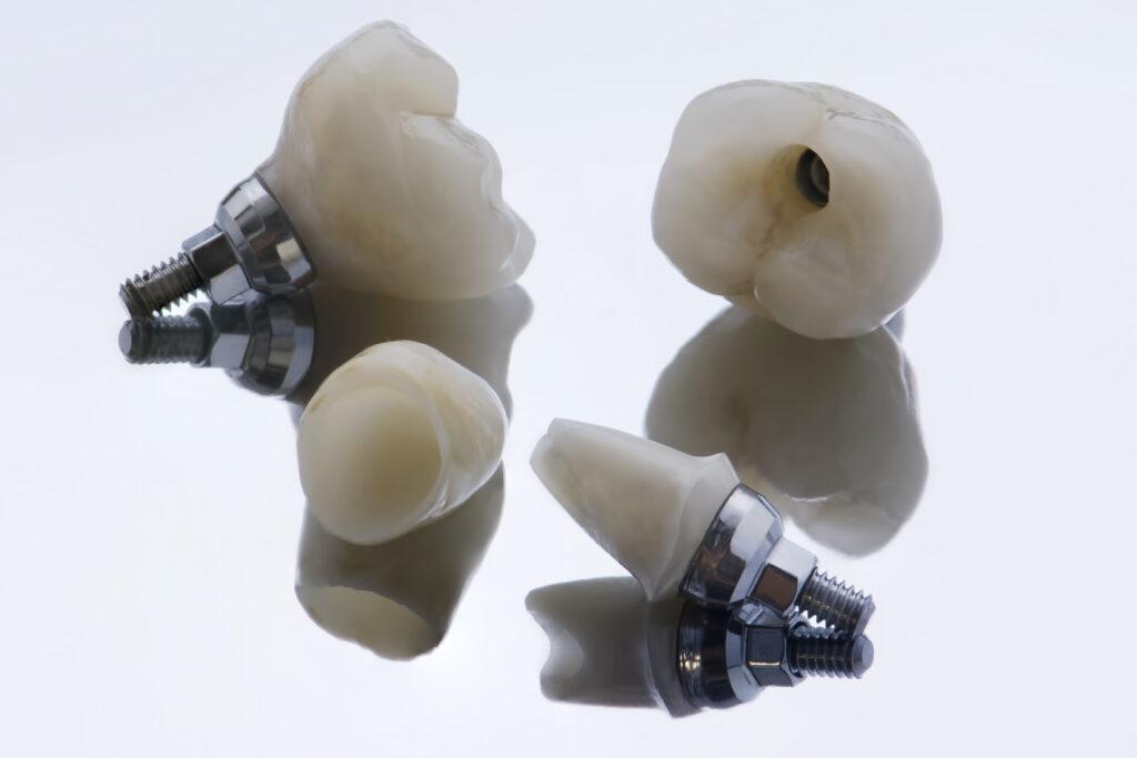 Implant Crown