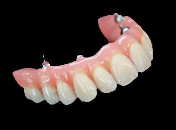 Zirconium Abutment