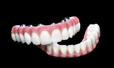 Zirconium Abutment