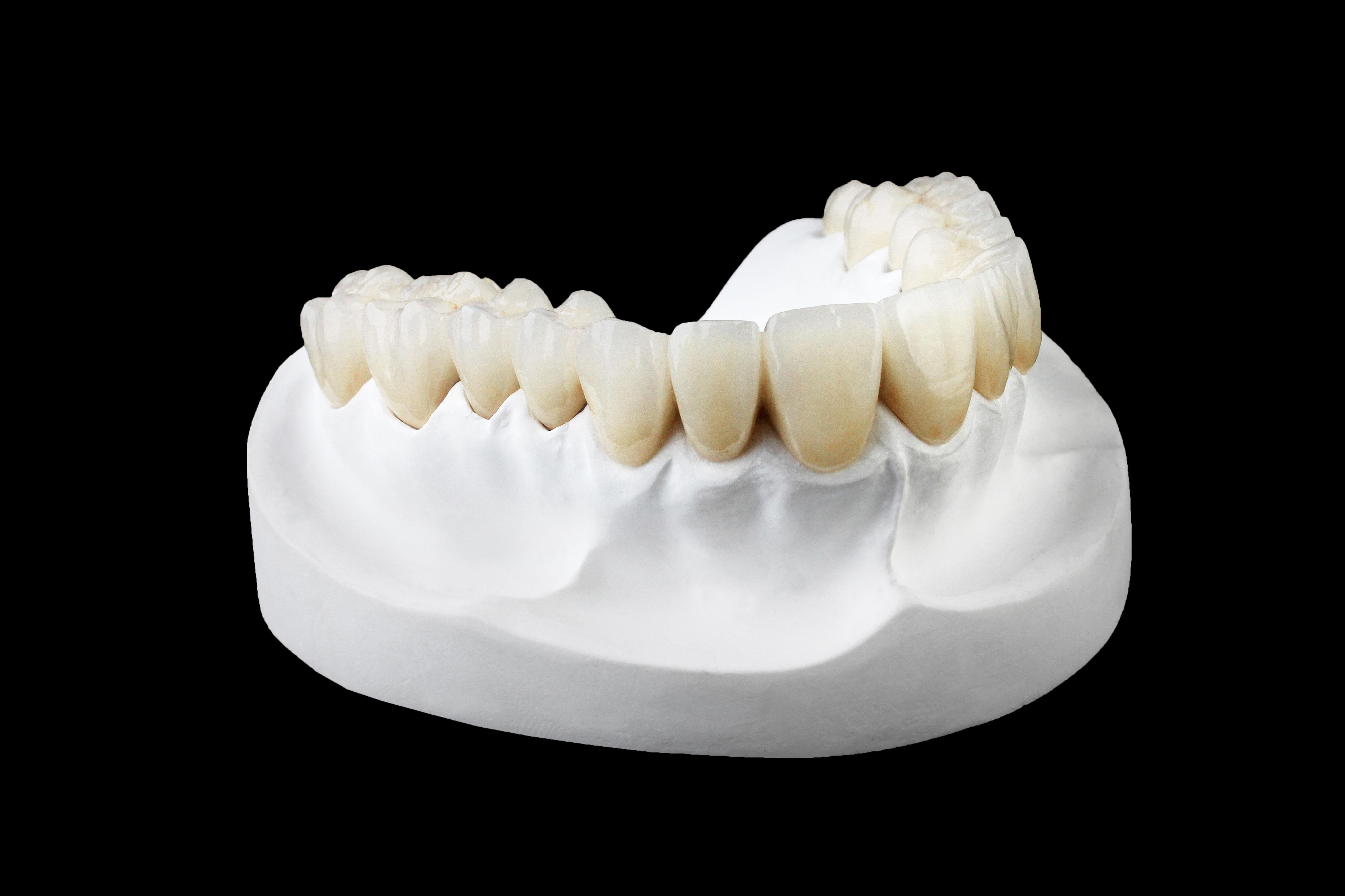 Layered Zirconia