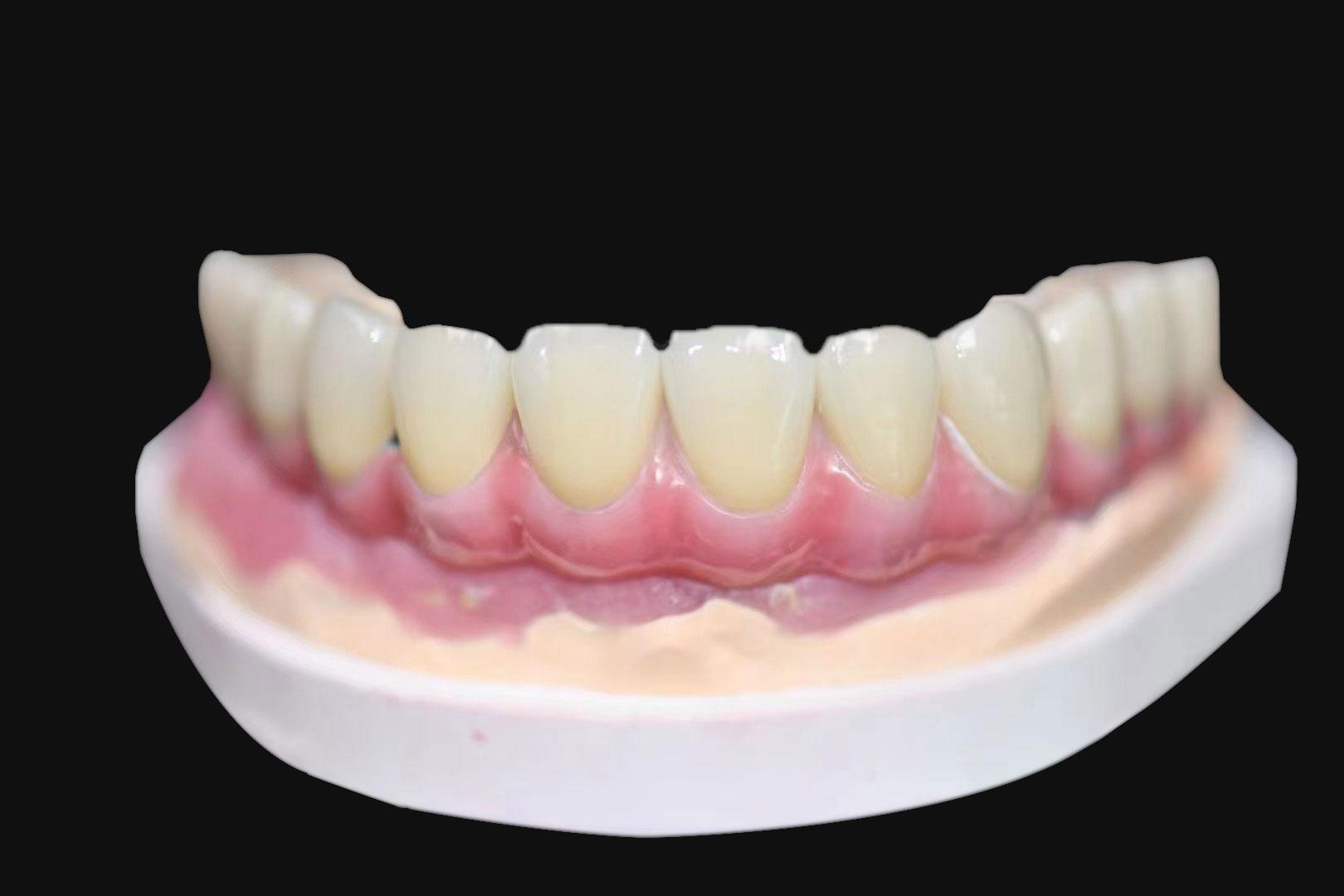 Layered Zirconia