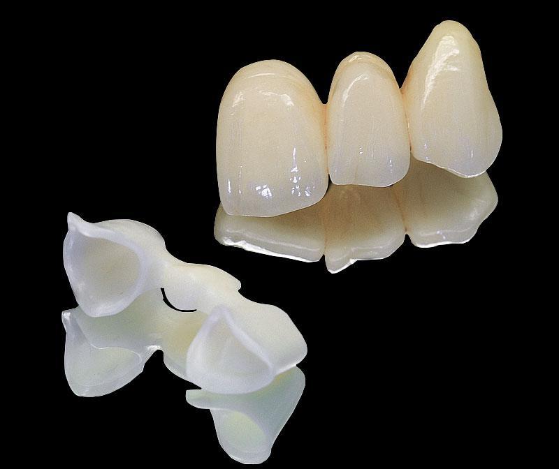 Implants