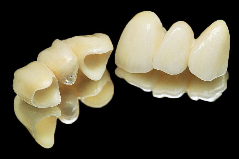 Full Zirconia