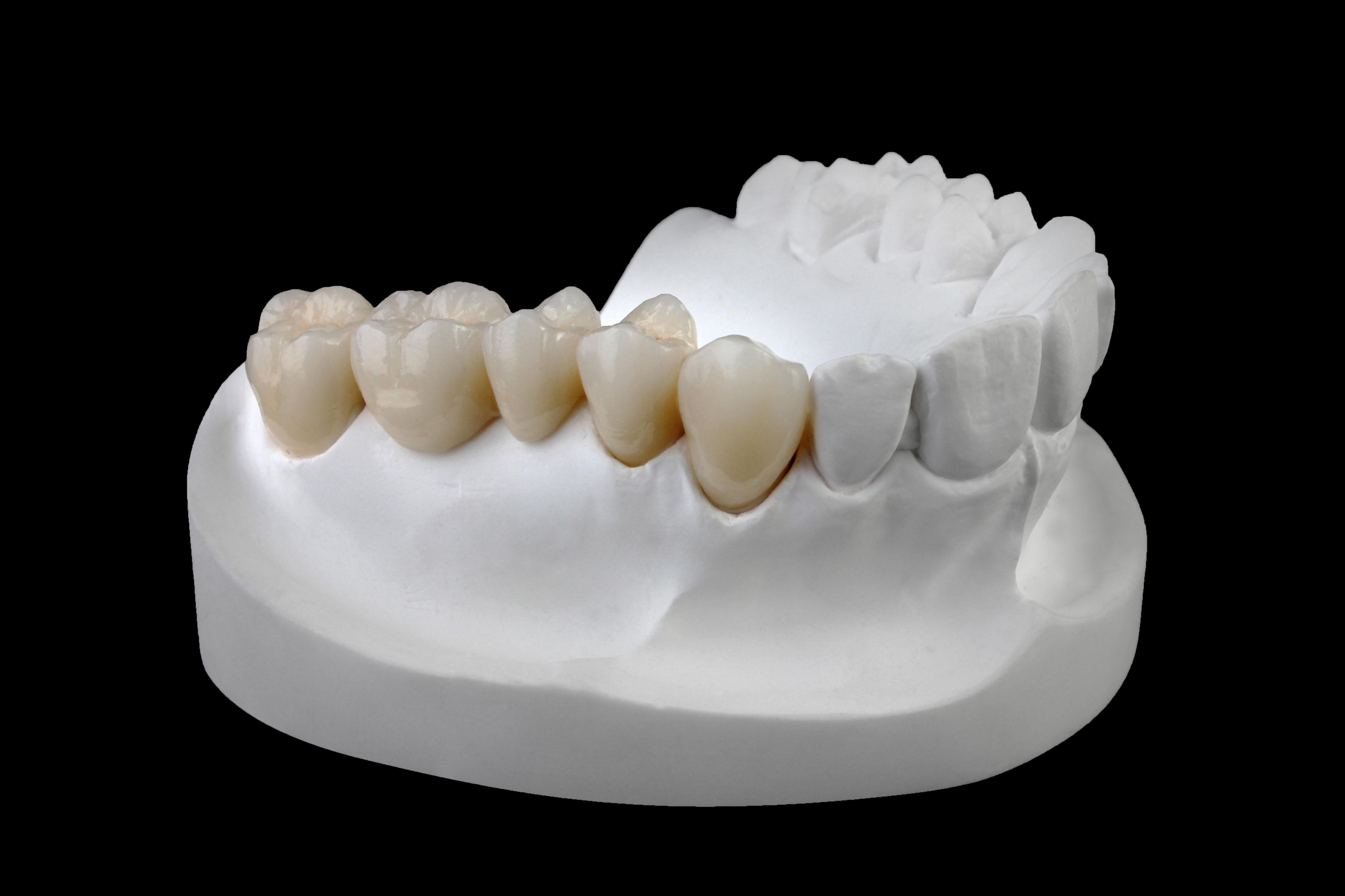 Layered Zirconia