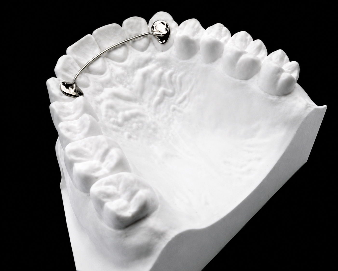 Hawley Retainer