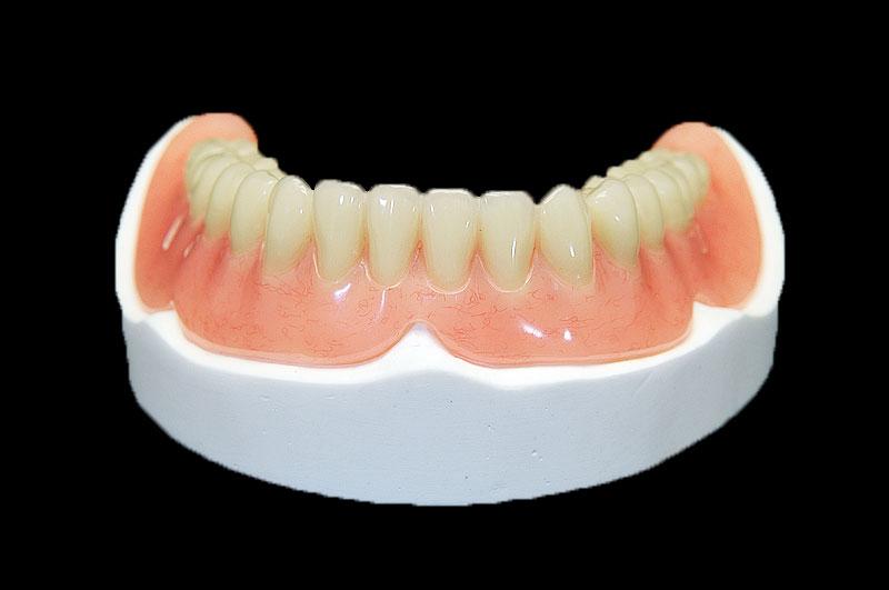 Full-Denture