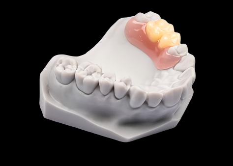 Partial-Denture