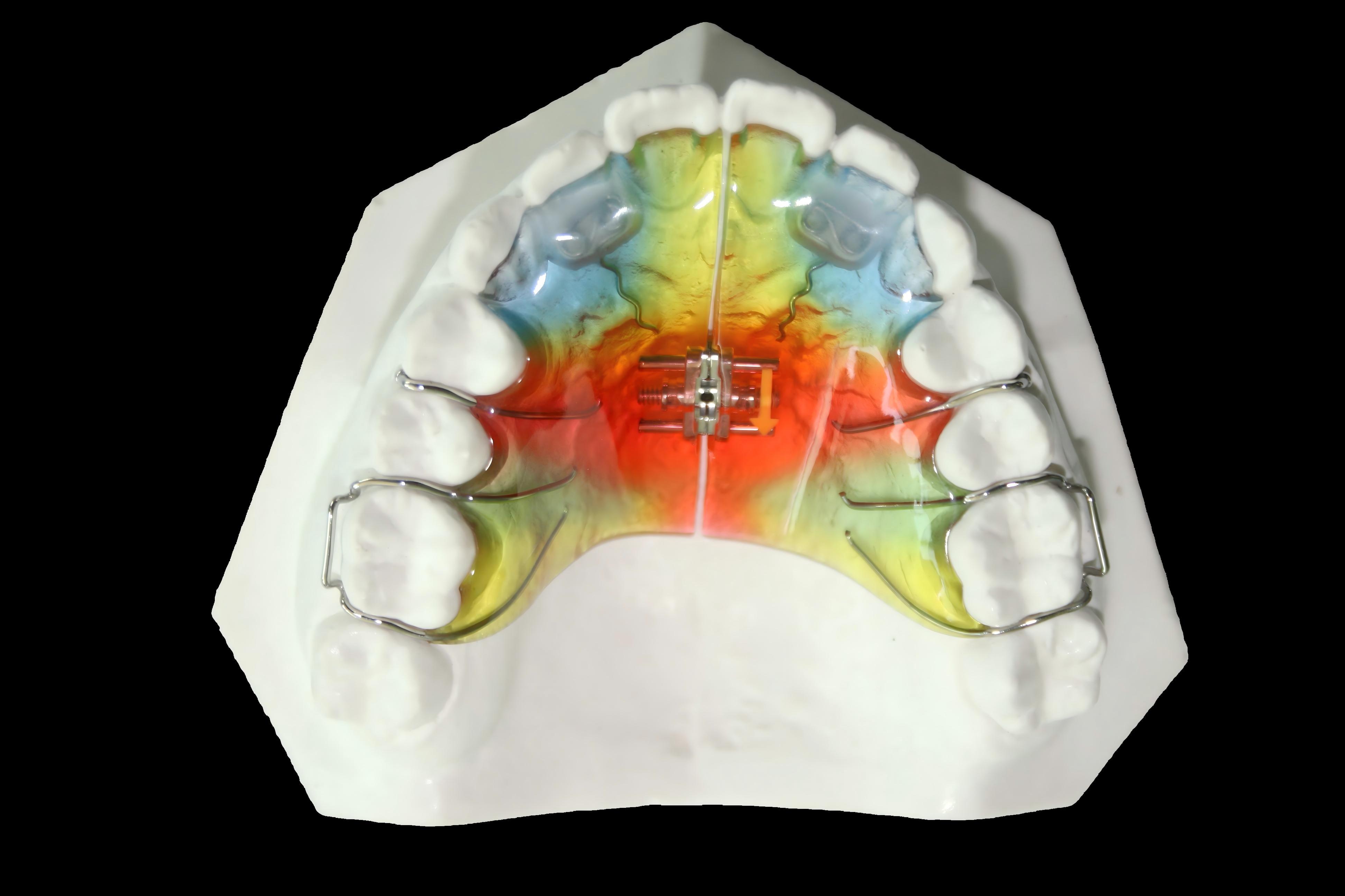 Hawley Retainer